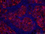ICAM-1 Antibody in Immunohistochemistry (PFA fixed) (IHC (PFA))