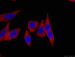HSP90 Antibody in Immunocytochemistry (ICC/IF)