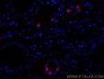 Gastrin Antibody in Immunohistochemistry (PFA fixed) (IHC (PFA))