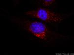 CD107a/LAMP1 Antibody in Immunocytochemistry (ICC/IF)