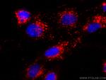 CD107b/LAMP2 Antibody in Immunocytochemistry (ICC/IF)