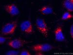 CD107b/LAMP2 Antibody in Immunocytochemistry (ICC/IF)