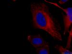 Bcl-XL Antibody in Immunocytochemistry (ICC/IF)