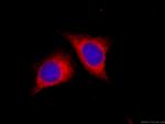 CYB5R3 Antibody in Immunocytochemistry (ICC/IF)