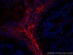 Fibronectin Antibody in Immunohistochemistry (PFA fixed) (IHC (PFA))
