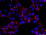 Fibronectin Antibody in Immunocytochemistry (ICC/IF)