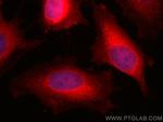 UBE2C Antibody in Immunocytochemistry (ICC/IF)