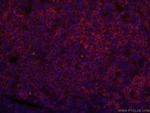 CD22 Antibody in Immunohistochemistry (PFA fixed) (IHC (PFA))