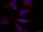 APOL1-Specific Antibody in Immunocytochemistry (ICC/IF)