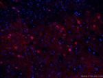 NSE Antibody in Immunohistochemistry (PFA fixed) (IHC (PFA))