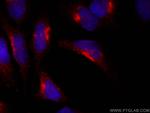 RCAS1 Antibody in Immunocytochemistry (ICC/IF)