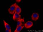 Zinc Alpha 2 Glycoprotein Antibody in Immunocytochemistry (ICC/IF)