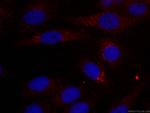 IDH1 Antibody in Immunocytochemistry (ICC/IF)