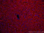 Mcp1 Antibody in Immunohistochemistry (PFA fixed) (IHC (PFA))