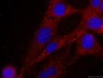 MYL3 Antibody in Immunocytochemistry (ICC/IF)