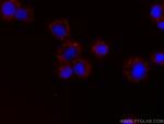 BDNF Antibody in Immunocytochemistry (ICC/IF)