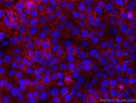 EPCAM Antibody in Immunocytochemistry (ICC/IF)