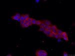 EPCAM Antibody in Immunocytochemistry (ICC/IF)