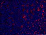 Fascin Antibody in Immunohistochemistry (PFA fixed) (IHC (PFA))