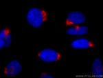 GP73/GOLPH2 Antibody in Immunocytochemistry (ICC/IF)