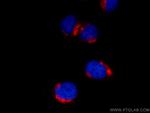 GP73/GOLPH2 Antibody in Immunocytochemistry (ICC/IF)