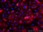 Annexin A1 Antibody in Immunocytochemistry (ICC/IF)