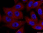 ZC3HAV1 Antibody in Immunocytochemistry (ICC/IF)