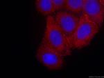 PKC alpha Antibody in Immunocytochemistry (ICC/IF)