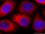 PDI Antibody in Immunocytochemistry (ICC/IF)