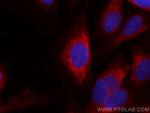 PDIA3 Antibody in Immunocytochemistry (ICC/IF)