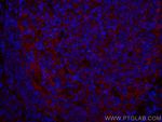 CD147 Antibody in Immunohistochemistry (PFA fixed) (IHC (PFA))
