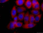 SLP76 Antibody in Immunocytochemistry (ICC/IF)