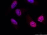 CCAR2 Antibody in Immunocytochemistry (ICC/IF)