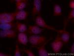SP1 Antibody in Immunocytochemistry (ICC/IF)