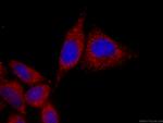 NF-KB p65 Antibody in Immunocytochemistry (ICC/IF)