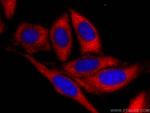 TWIST2 Antibody in Immunocytochemistry (ICC/IF)