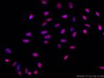 SMARCA4 Antibody in Immunocytochemistry (ICC/IF)