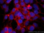 FAF2 Antibody in Immunocytochemistry (ICC/IF)