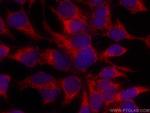 RASGRP3 Antibody in Immunocytochemistry (ICC/IF)