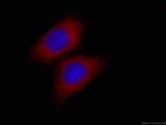 EIF4E Antibody in Immunocytochemistry (ICC/IF)