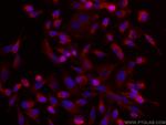 MST1 Antibody in Immunocytochemistry (ICC/IF)