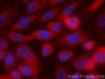 MST1 Antibody in Immunocytochemistry (ICC/IF)