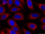 PDIA6 Antibody in Immunocytochemistry (ICC/IF)