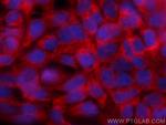 STRAP Antibody in Immunocytochemistry (ICC/IF)