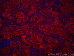 SSTR5 Antibody in Immunohistochemistry (PFA fixed) (IHC (PFA))