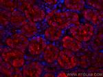 SSTR5 Antibody in Immunohistochemistry (PFA fixed) (IHC (PFA))