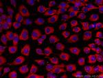 FNTB Antibody in Immunocytochemistry (ICC/IF)