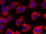 FNTB Antibody in Immunocytochemistry (ICC/IF)