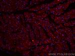 SOCS3 Antibody in Immunohistochemistry (PFA fixed) (IHC (PFA))