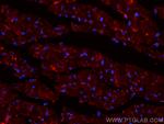 SOCS3 Antibody in Immunohistochemistry (PFA fixed) (IHC (PFA))